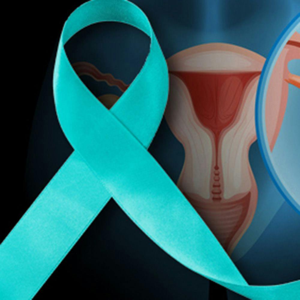 Better Understanding of Ovarian Cancer Is Needed, Expert Says