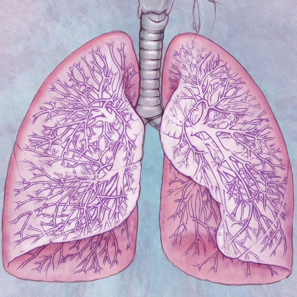 Expert Discusses Changing Field of Lung Cancer Care