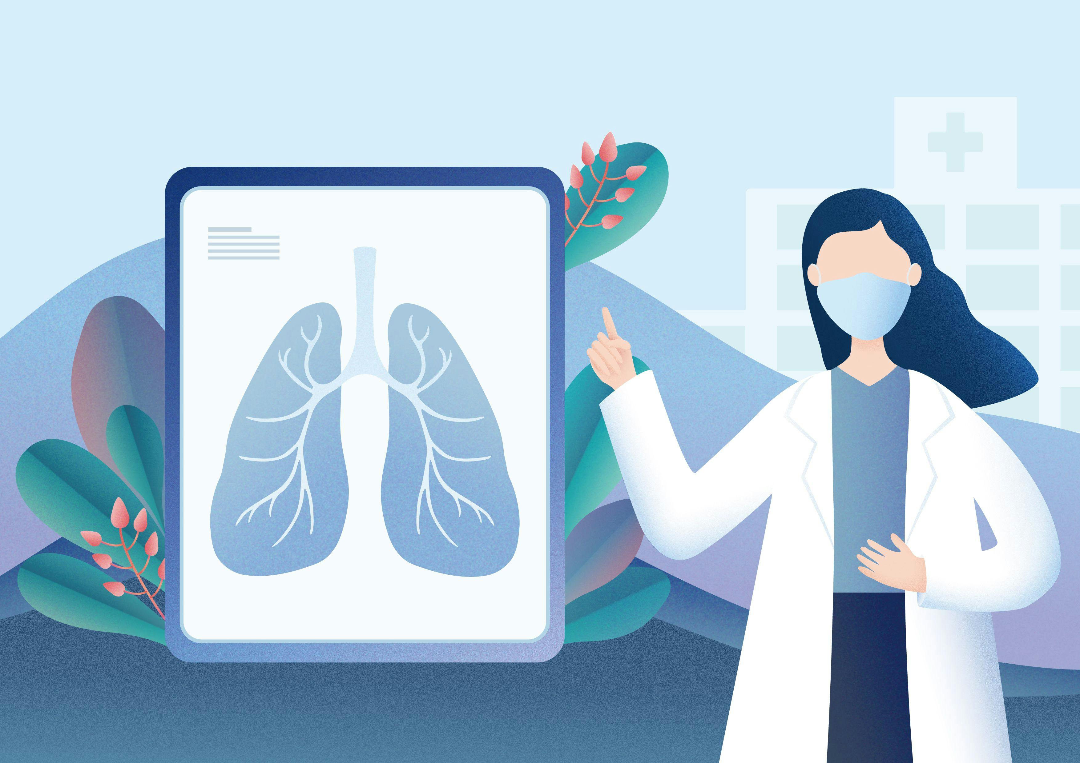 Illustration of a doctor with a face mask pointing at a larger graphic of lungs, signifying lung cancer.