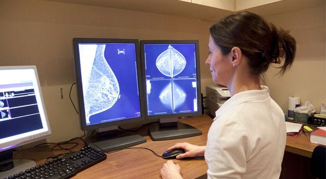 FDA Advances Landmark Policy Changes to Modernize Mammography