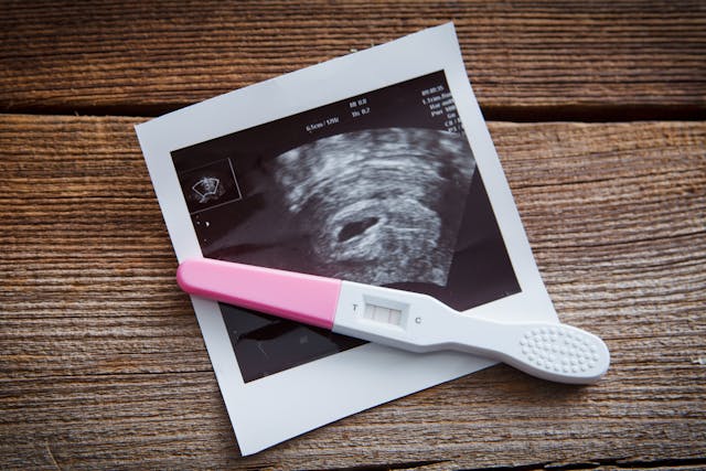 sonogram and positive pregnancy test