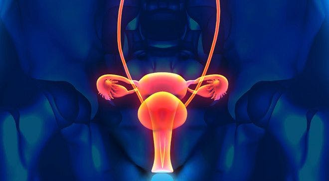 Initial PARP Inhibitor Use for Ovarian Cancer May Not Lead to Resistance in Secondary Use
