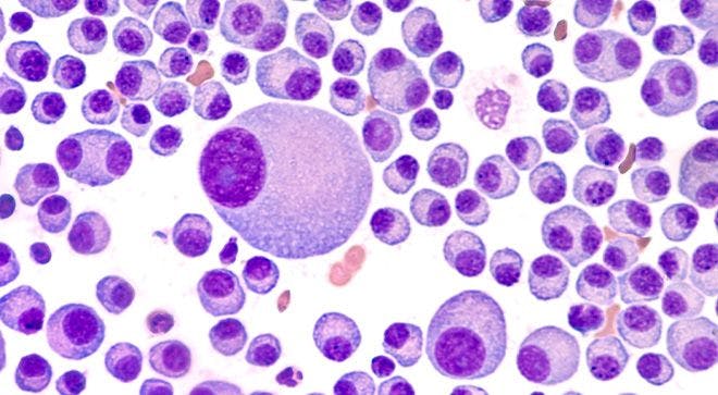 New Drug Will Be Studied in Relapsed/Refractory Myeloma, Other Blood Cancers