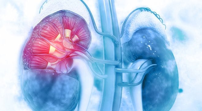 Surgery After Targeted or Immune Therapy Improves Health Outcomes in Some Patients with Metastatic Kidney Cancer