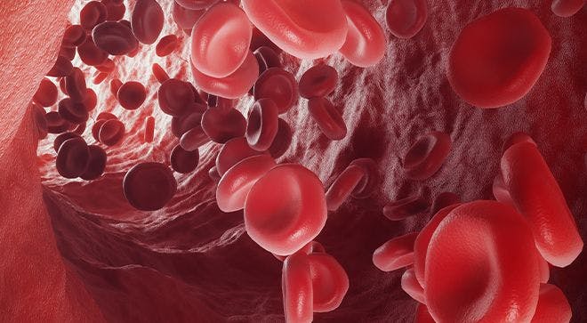 The 'Flipside' of Tumor Lysis Syndrome Shows Efficacy in Leukemia, Lymphoma