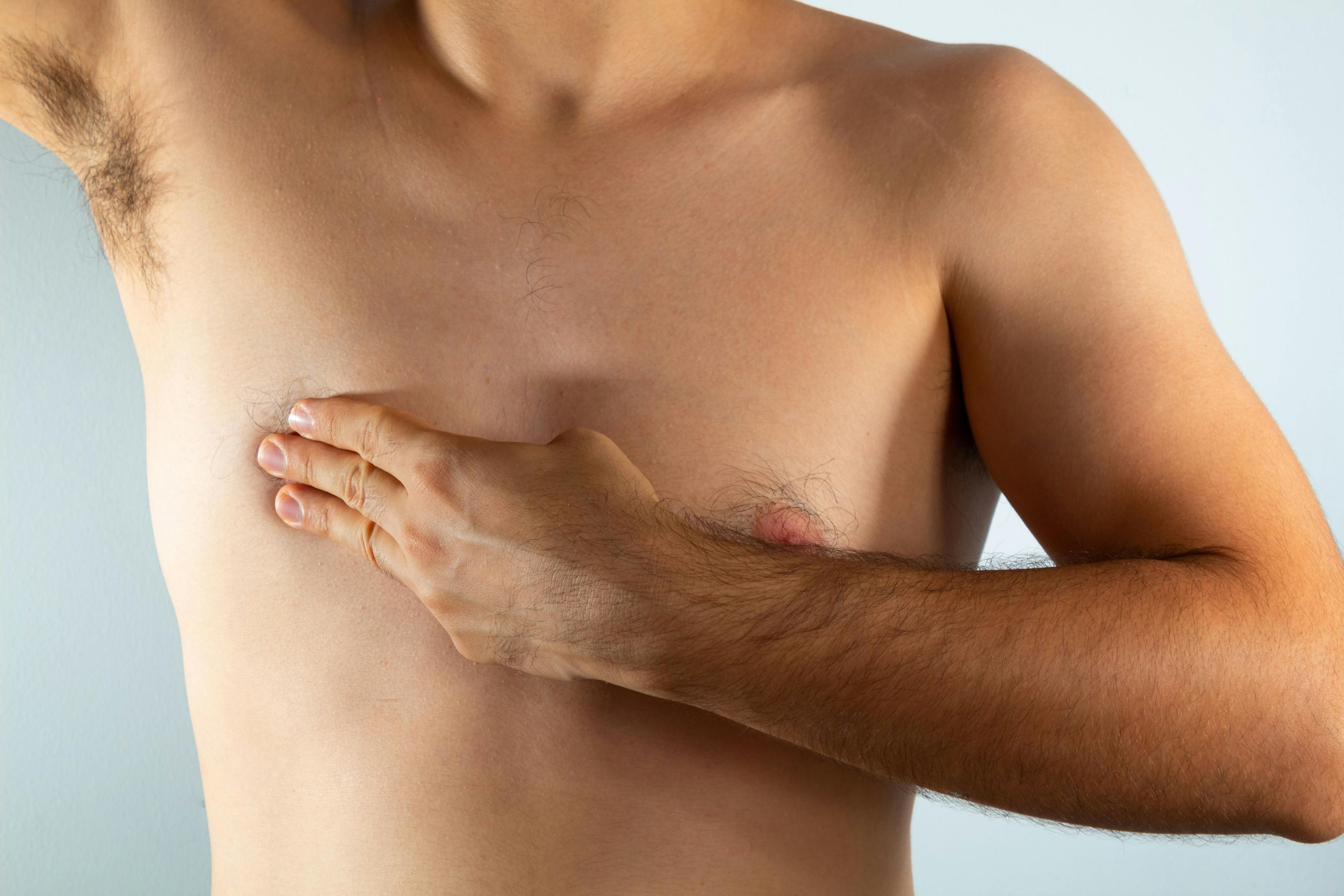 close up of a man's chest looking for signs of male breast cancer | Image credit: © Antonio Tanaka - © stock.adobe.com