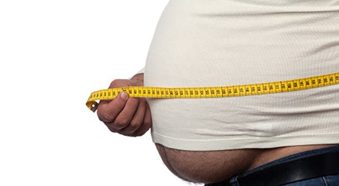 Increasing Myeloma and Other Cancer Incidence in Younger Adults Points to Obesity Epidemic