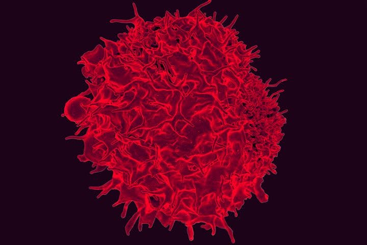 Testing a New Immunotherapy Combo in Advanced Pancreatic Cancer