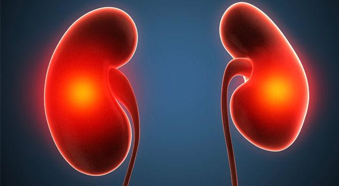 Survey Results Highlight Unmet Needs of Patients with Kidney Cancer Worldwide