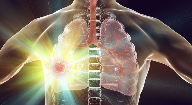 EDUCATED PATIENT Lung Cancer Webinar: Western Region