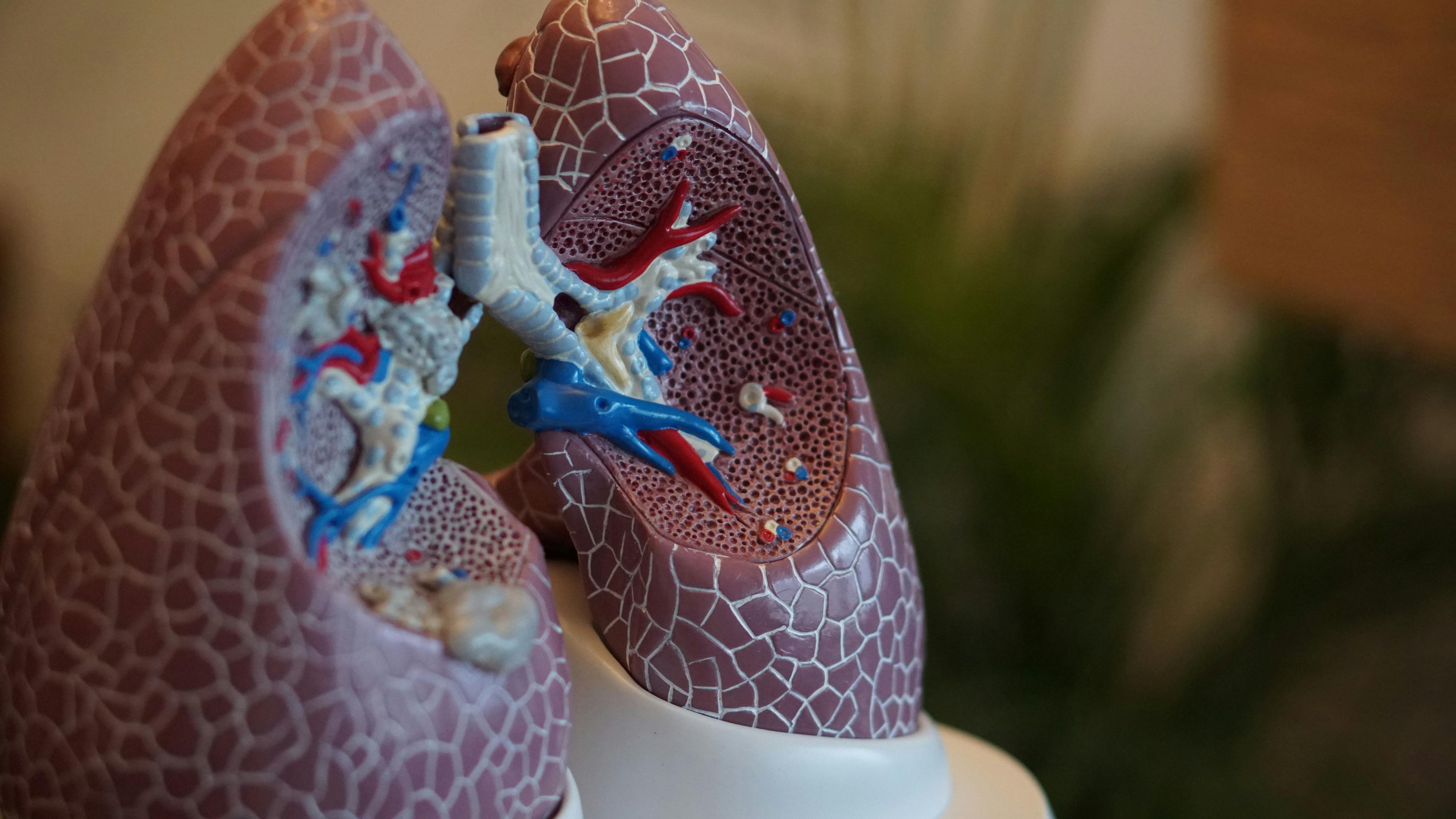 Top 5 Lung Cancer-Related Stories of 2021 