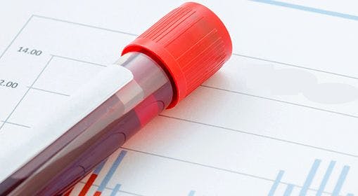 Blood Test May Identify Candidates for Early Lung Cancer Screening