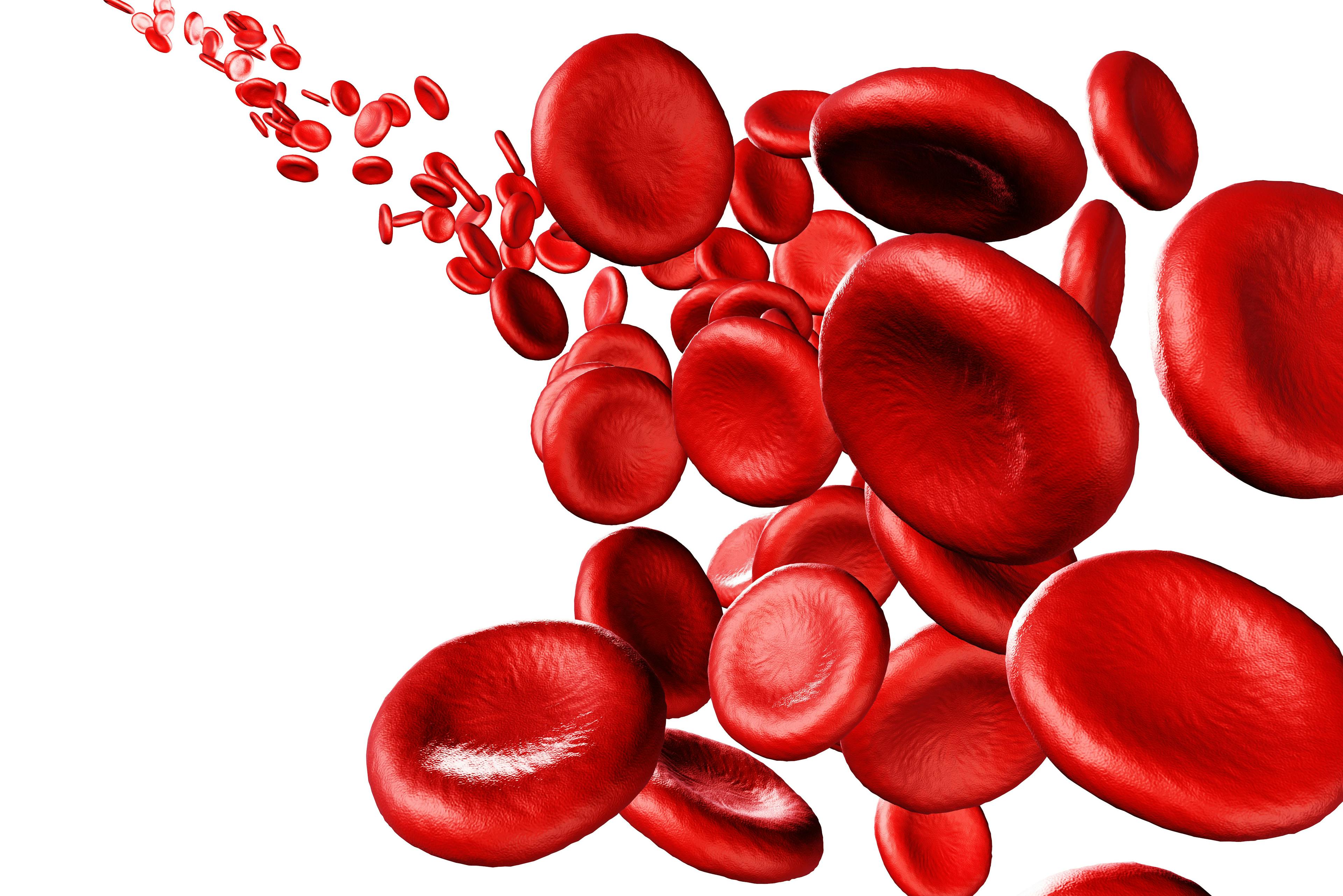 Understanding the Variability of a Rare Blood Cancer