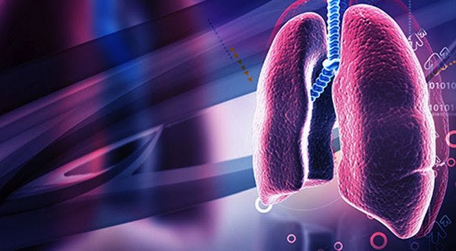 Two-Drug Combo Bests Chemotherapy in Front-Line Lung Cancer Treatment