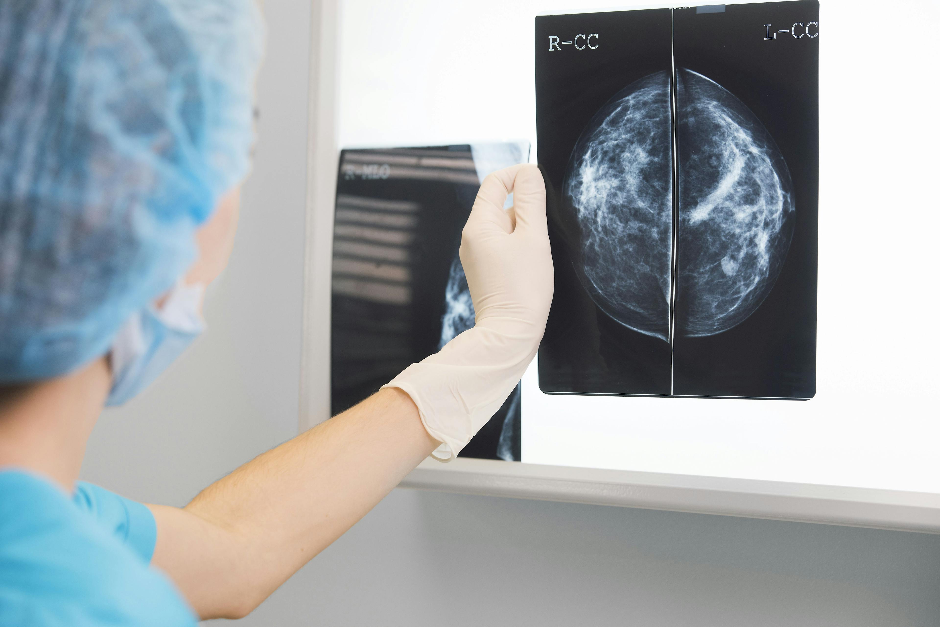 National Organization Recommends Women Delay Mammogram Screening Following COVID-19 Vaccine