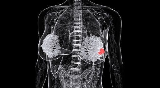 gray conceptual scan of body with red breast cancer tumor