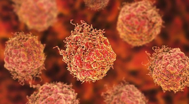 Lynparza Significantly Improves Survival in Subset of Patients with Metastatic Prostate Cancer