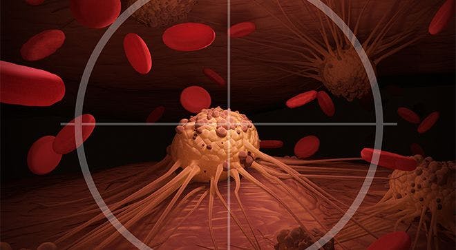 Advances in the Treatment of Mantle Cell Lymphoma are Greatly Improving the Long-Term Outlook for Patients