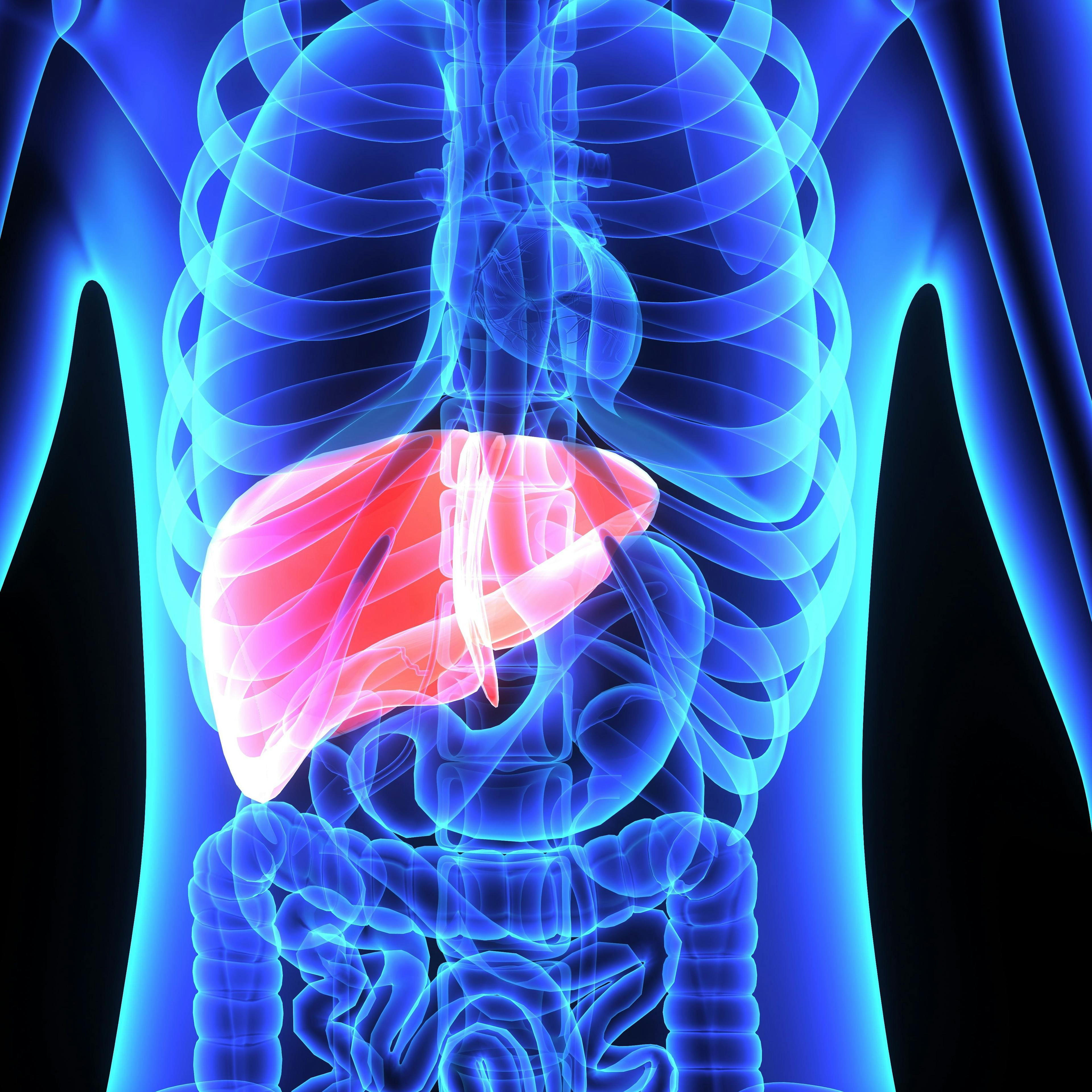 Minimally Invasive Procedure Combined with Lenvima and Checkpoint Blockade Shows Promise in Unresectable Liver Cancer