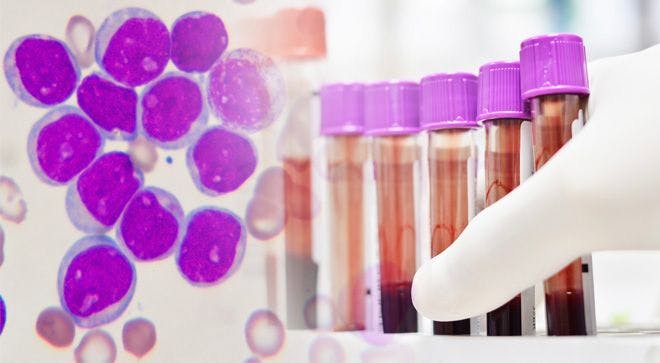 CLL chronic lymphocytic leukemia research trial regimen