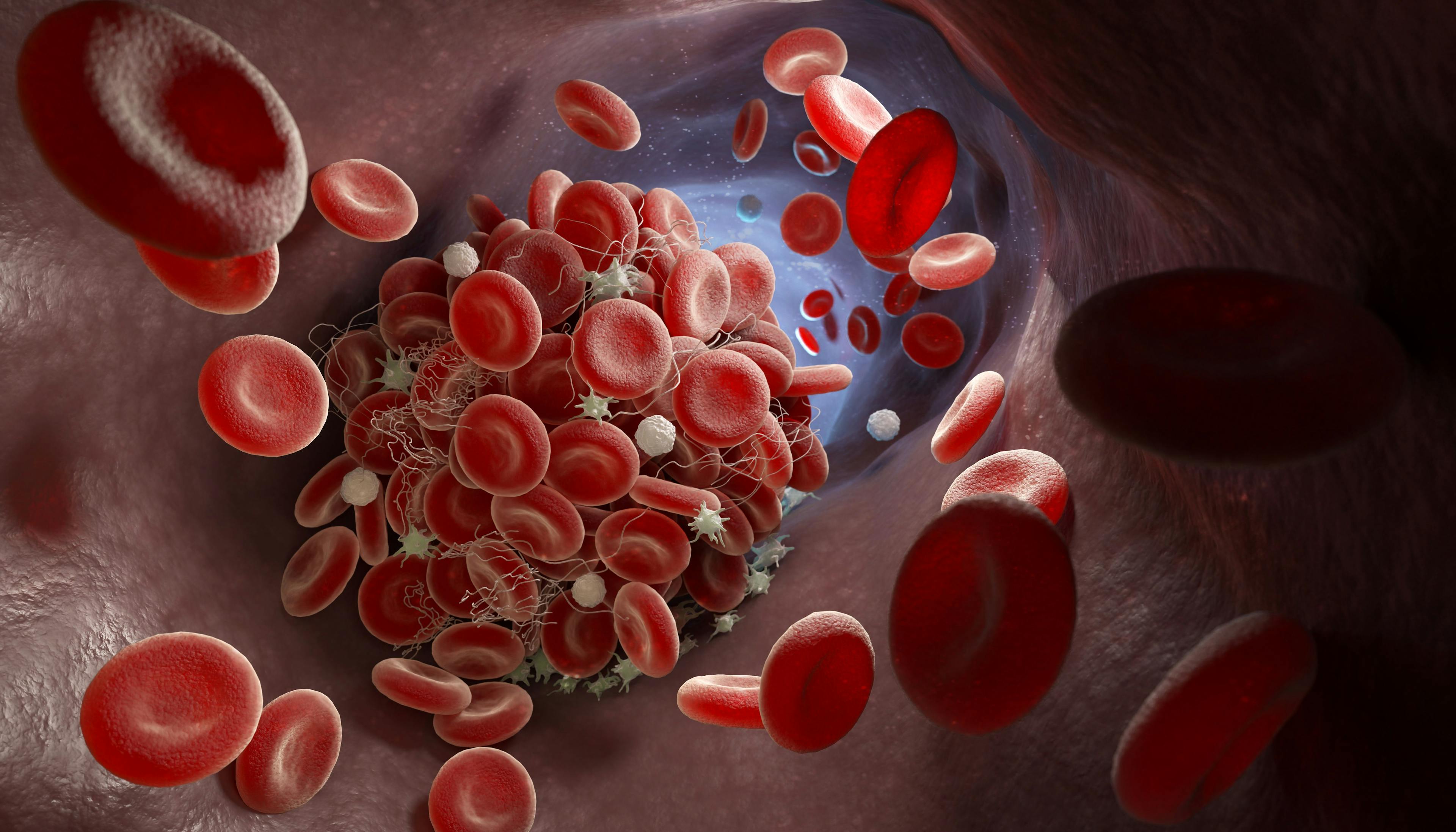 Formation of a blood clot | Image credit: © Tatiana Shepeleva - Tatiana Shepeleva stock.adobe.com