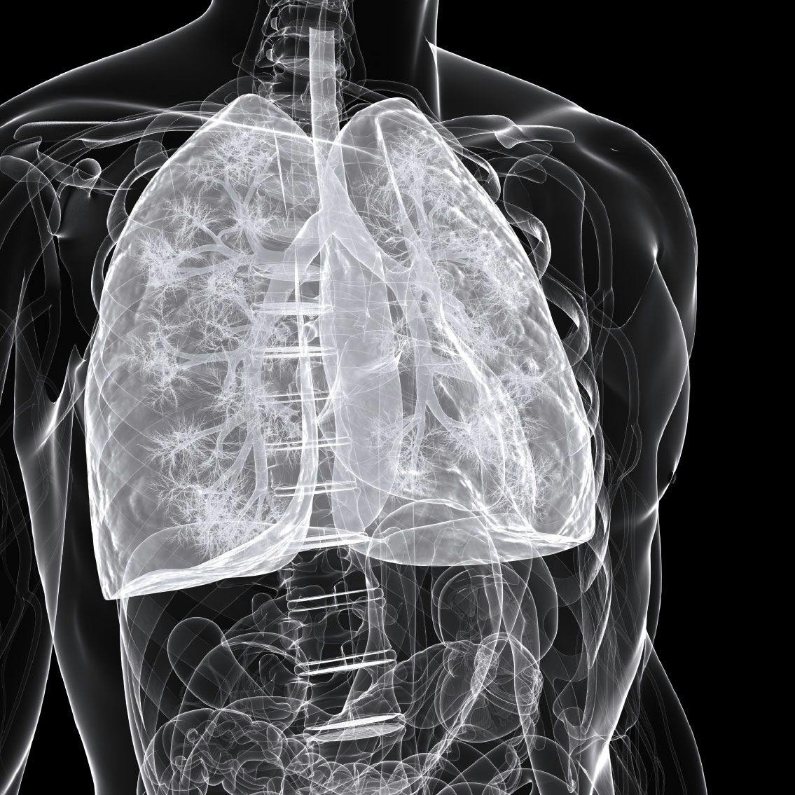 Keytruda Shows Benefit in Small Cell Lung Cancer