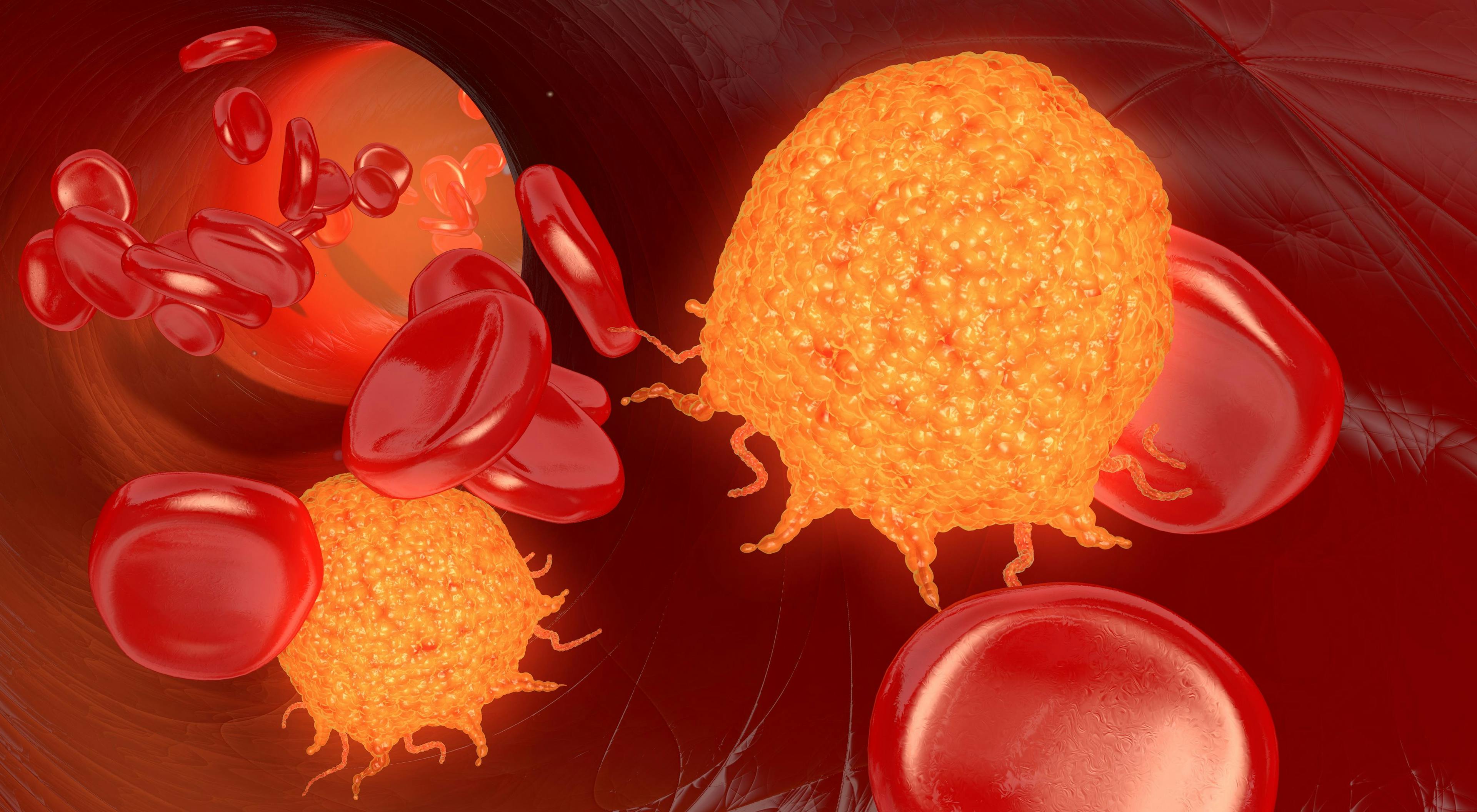 Blood Cancer Therapies May Play a Role in Treating COVID-19