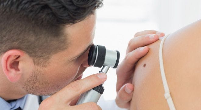 Mixing and Matching: Multiple Treatments in Sequence or Combination are Key in Fighting Melanoma