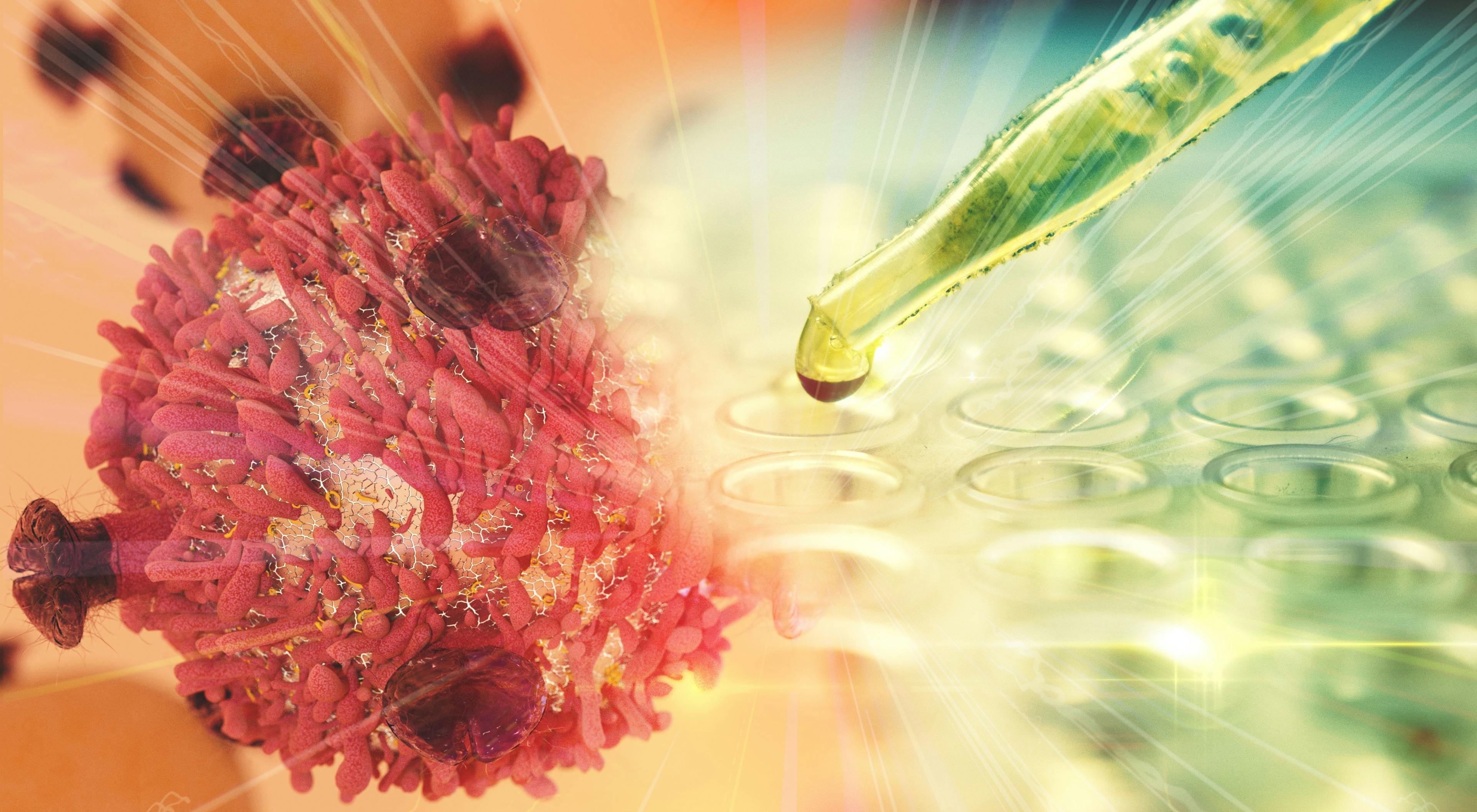 Immunotherapy May Mean No Chemotherapy for Some With Metastatic Head and Neck Cancer