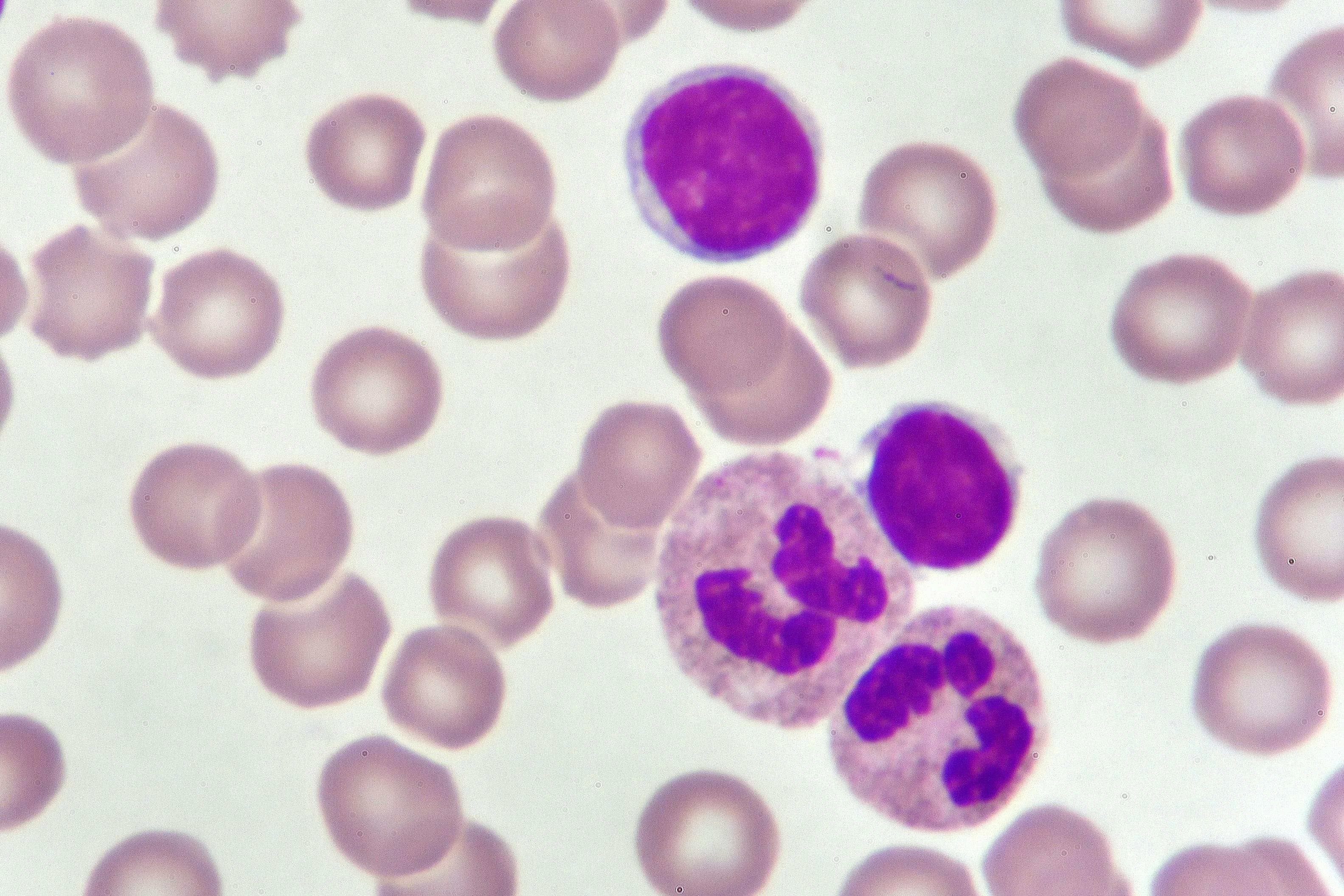 image of CLL