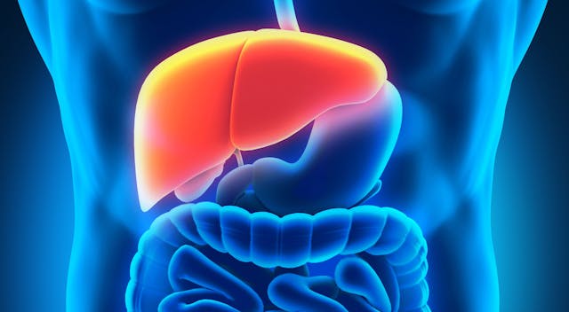 Imjudo-Imfinzi Regimen Improves Survival With Manageable Side Effects in Liver Cancer Subset