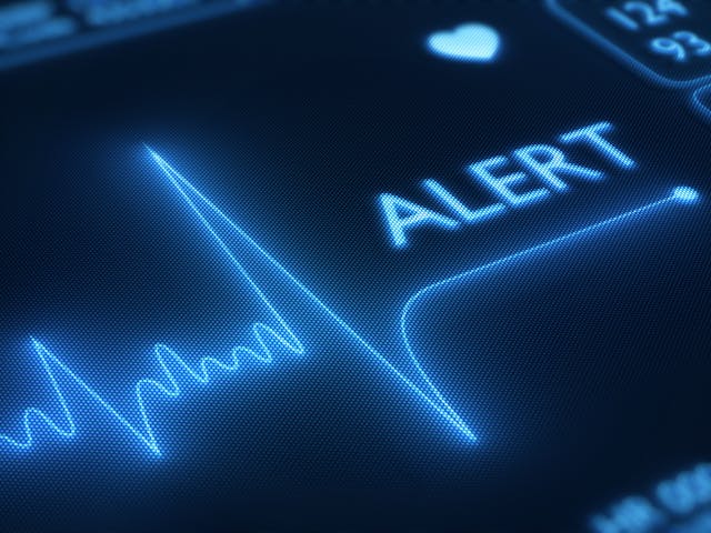 EKG reading with the word "alert" 