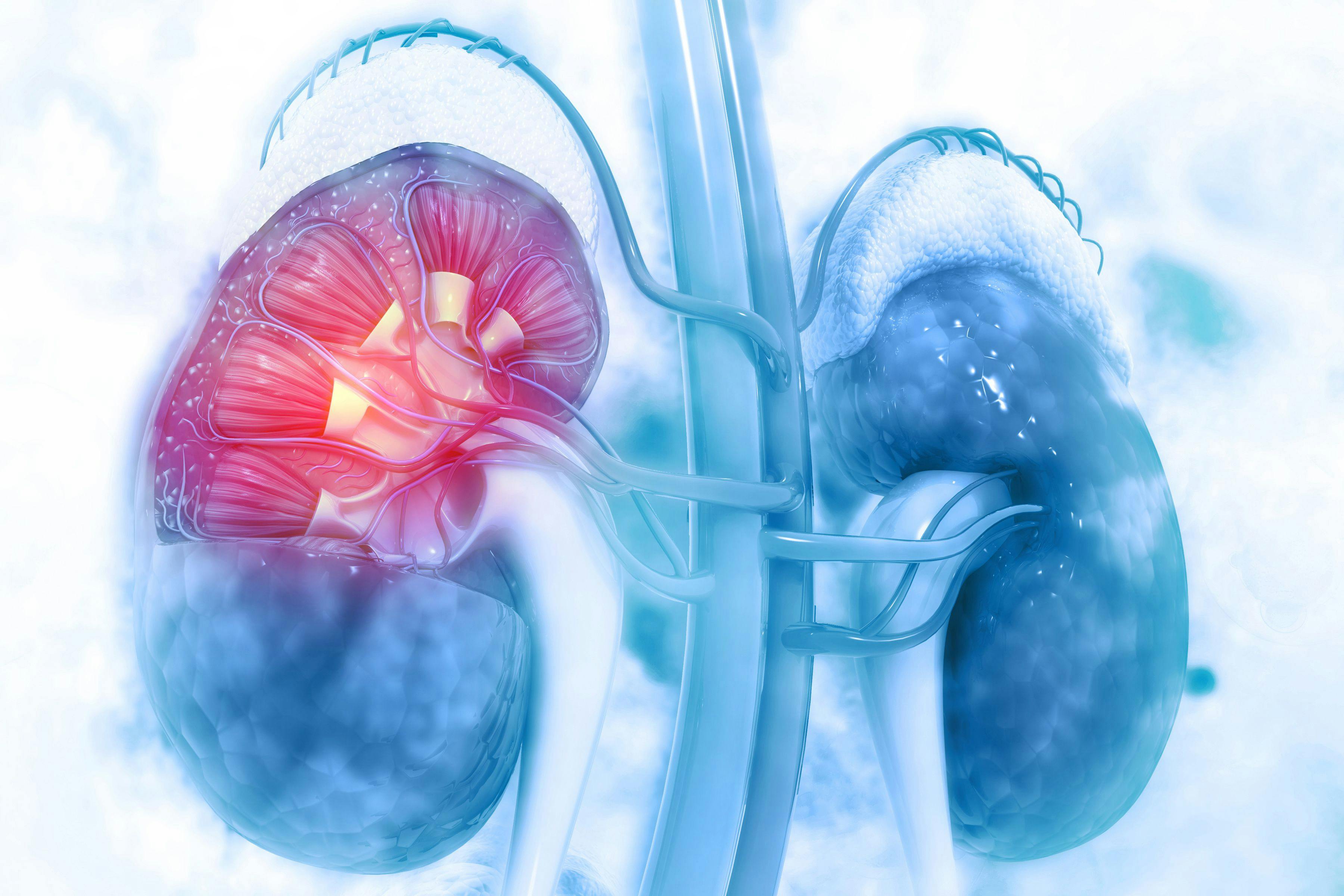 Cabometyx Significantly Prolongs Survival Over Sutent in Rare Form of Kidney Cancer