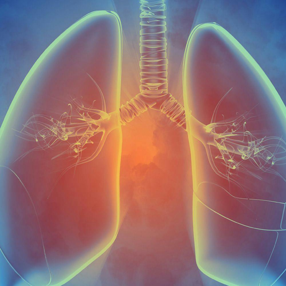 Findings Emphasize the Importance of Pursuing Treatment for Late-Stage Lung Cancer