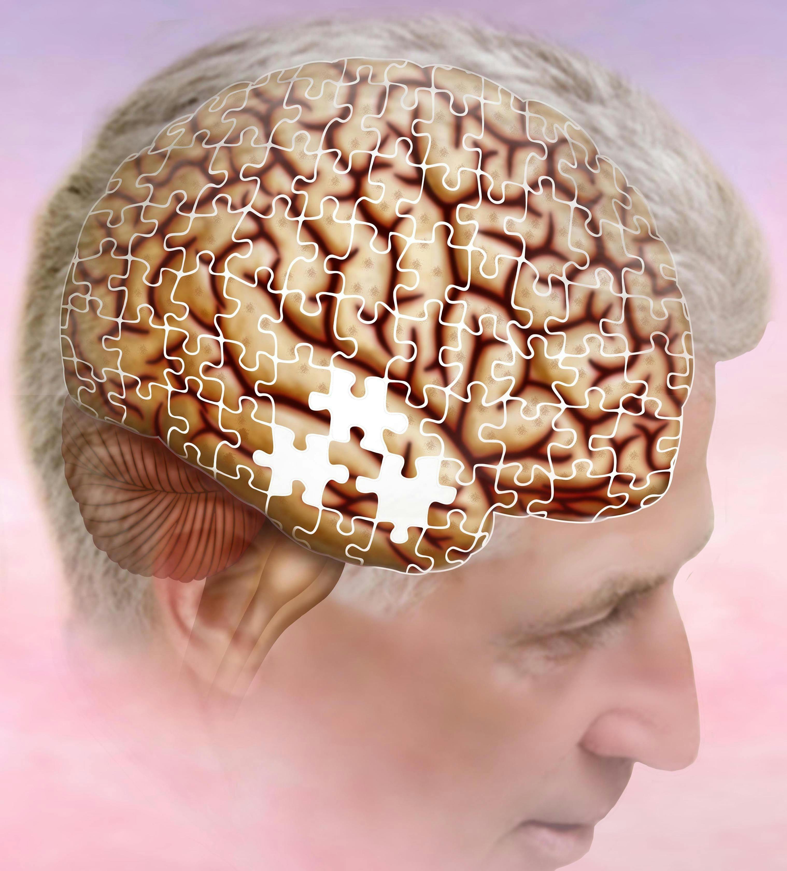 Short-Term Memory Recall Decline in AYA Cancer Survivors May Lead to an Increased Risk of Dementia, Alzheimer's