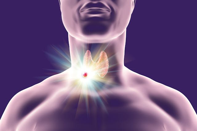 ‘Monumental’ Treatment Advancements Have Been ‘Life-Changing’ For Many Patients With Thyroid Cancer