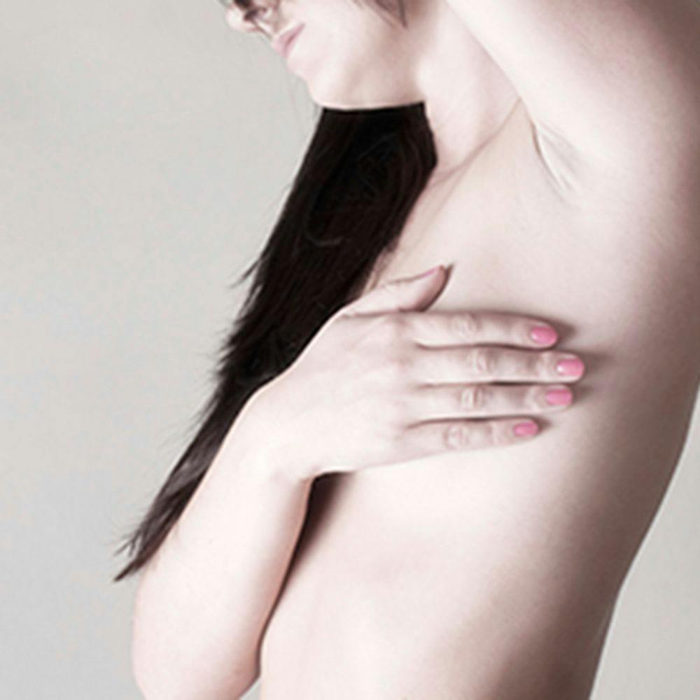 Saving Nipples During Mastectomy Does Not Increase Risk of Cancer Recurrence