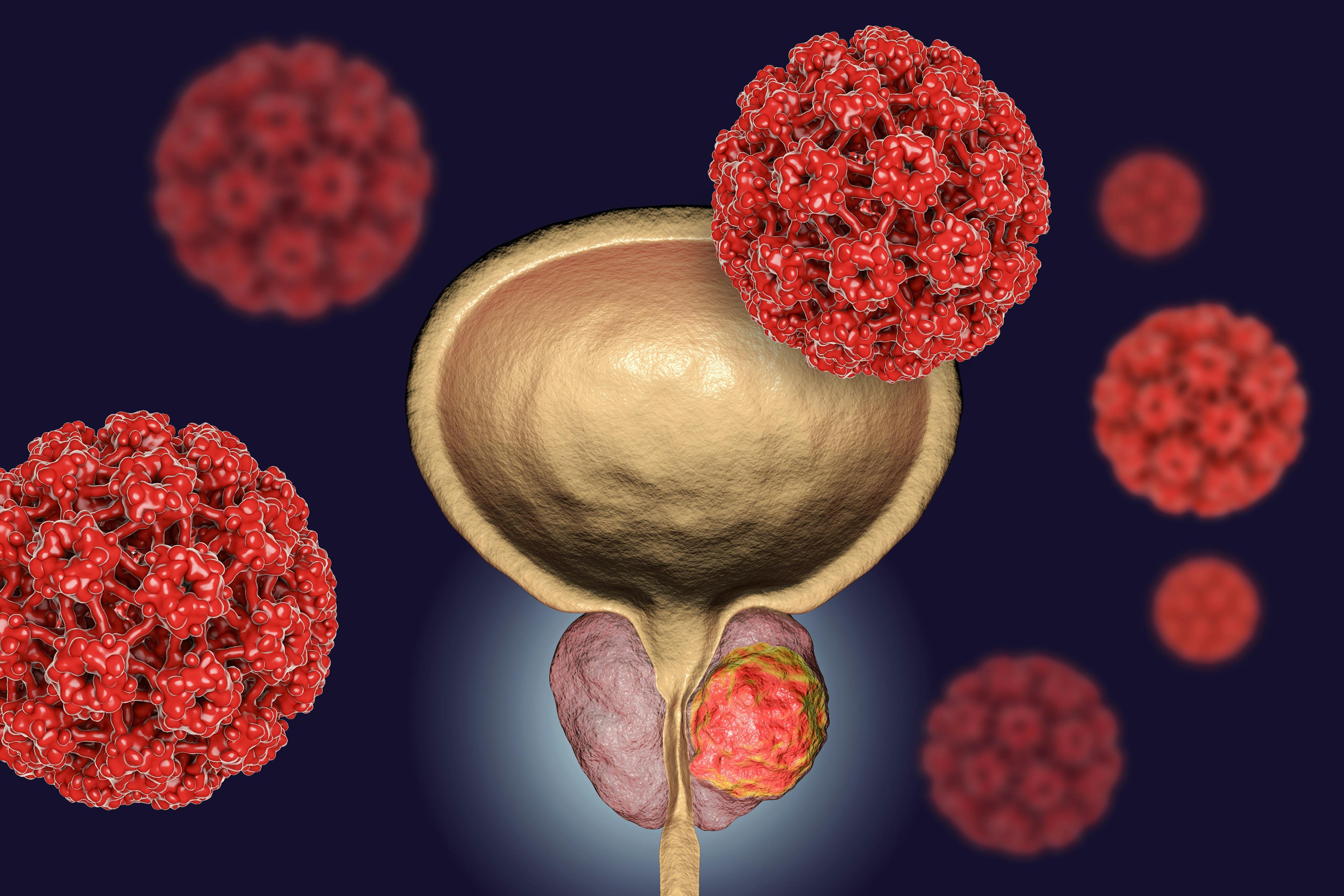 Padcev Continues to Show Promise in Patients with Previously Treated Bladder Cancer