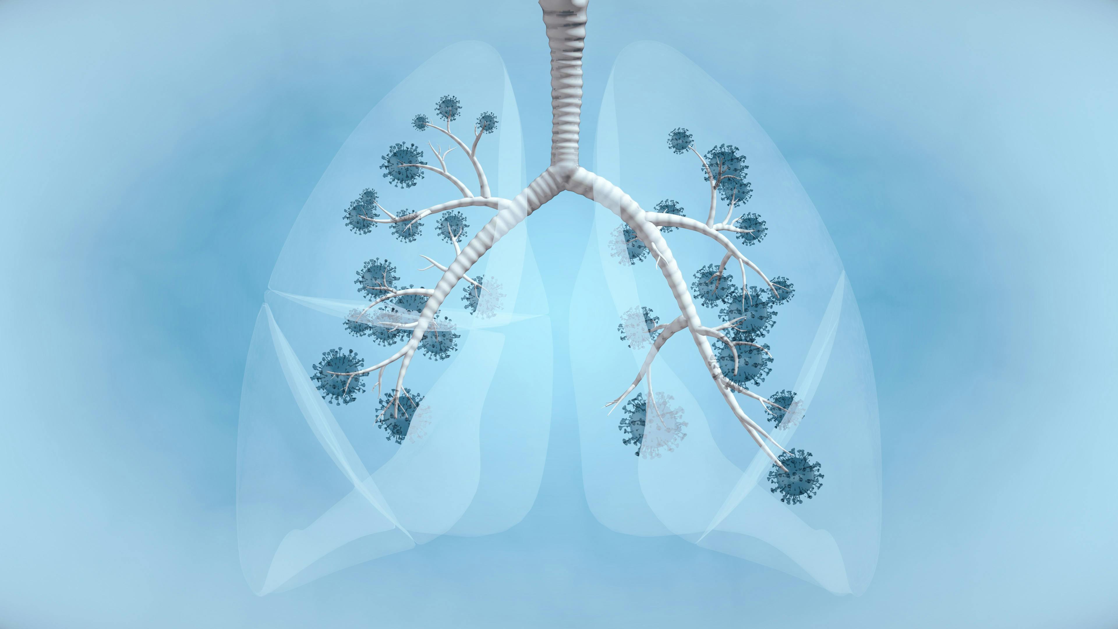 Light blue background with a pair of lungs with tumors displayed. 