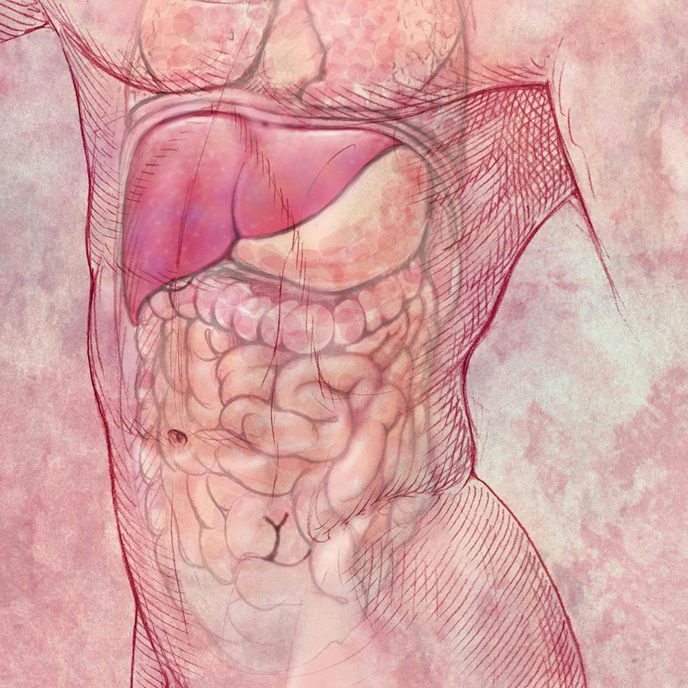 image of gastric cancer