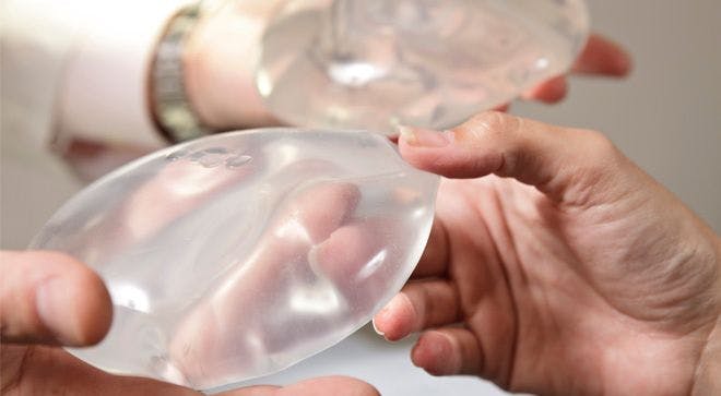 Breast Implants Stay on the Market, but FDA Wants to Know More About Rare Lymphoma and Autoimmune Syndrome