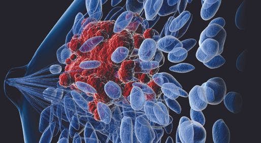 Antibody-Drug Conjugate Improves Responses in Metastatic Triple-Negative Breast Cancer