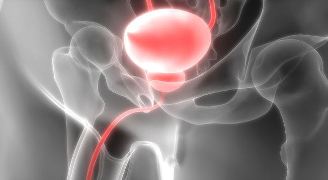 Lynparza Leads to Longer Survival in Men With Prostate Cancer