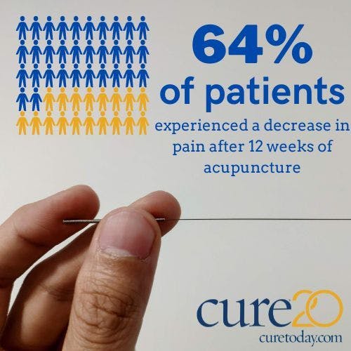More than half (64%) of patients with early-stage breast cancer who were receiving an aromatase inhibitor saw a clinically meaningful decrease in pain after undergoing 12 weeks of acupuncture, according to findings from a study published in 2021.