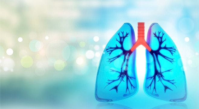 Immunotherapy Side Effects Could Mean Treatment Is Working in Non-Small Cell Lung Cancer