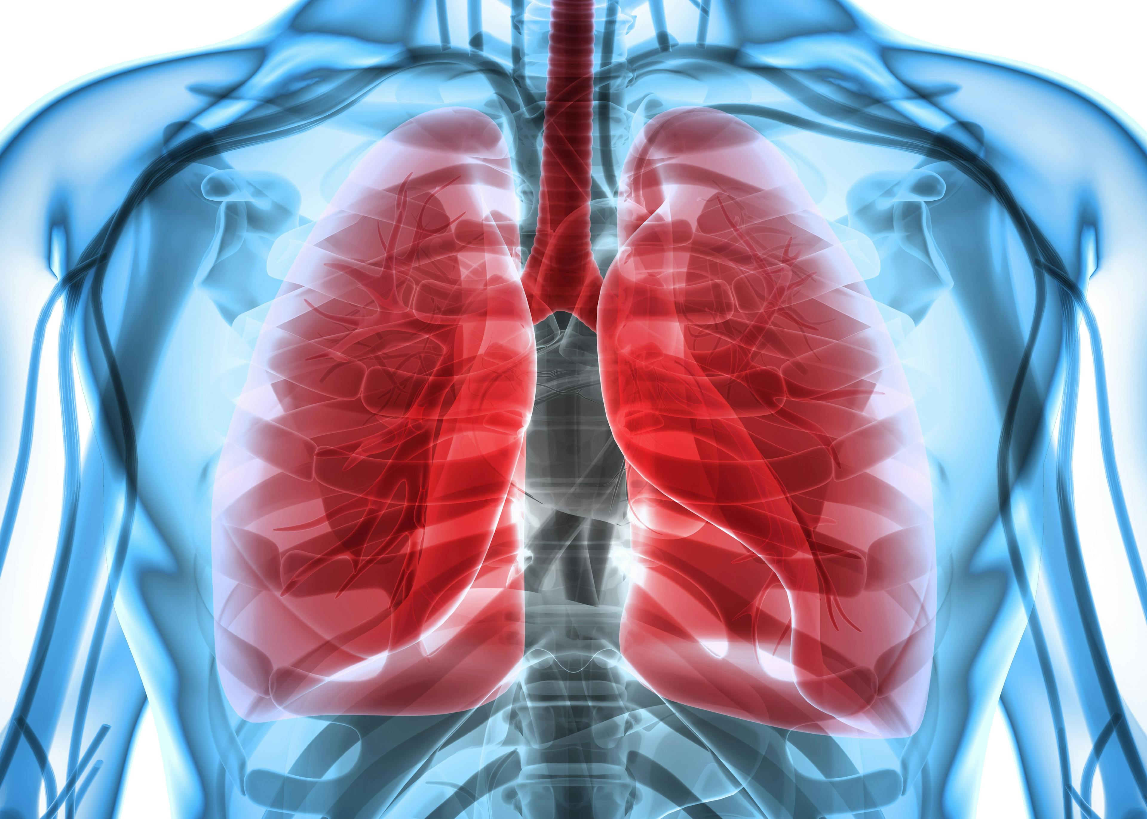 The Future of Adoptive Cellular Therapy in Lung Cancer