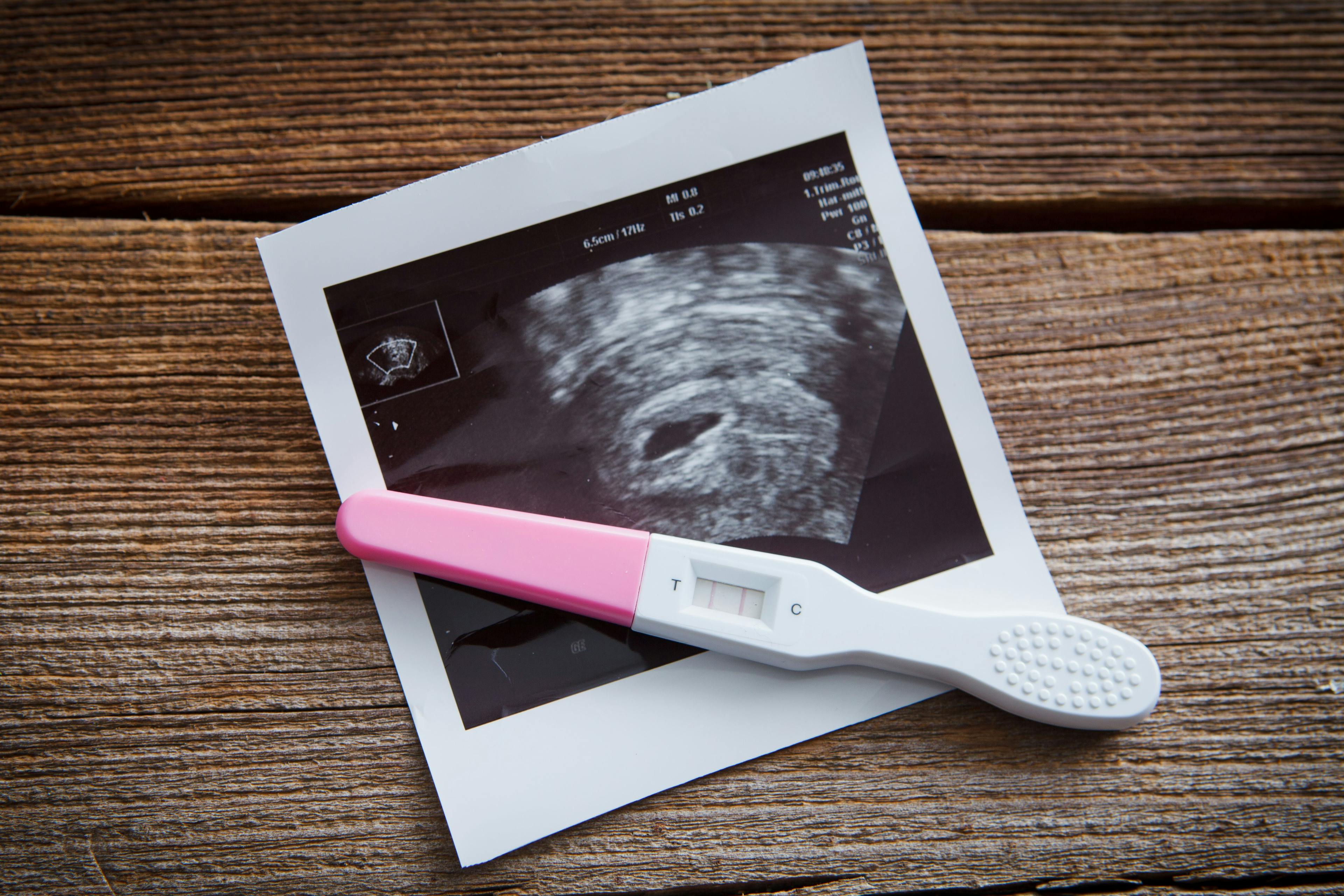 Pregnancy Test | Image credit: © Ramona Heim - © stock.adobe.com