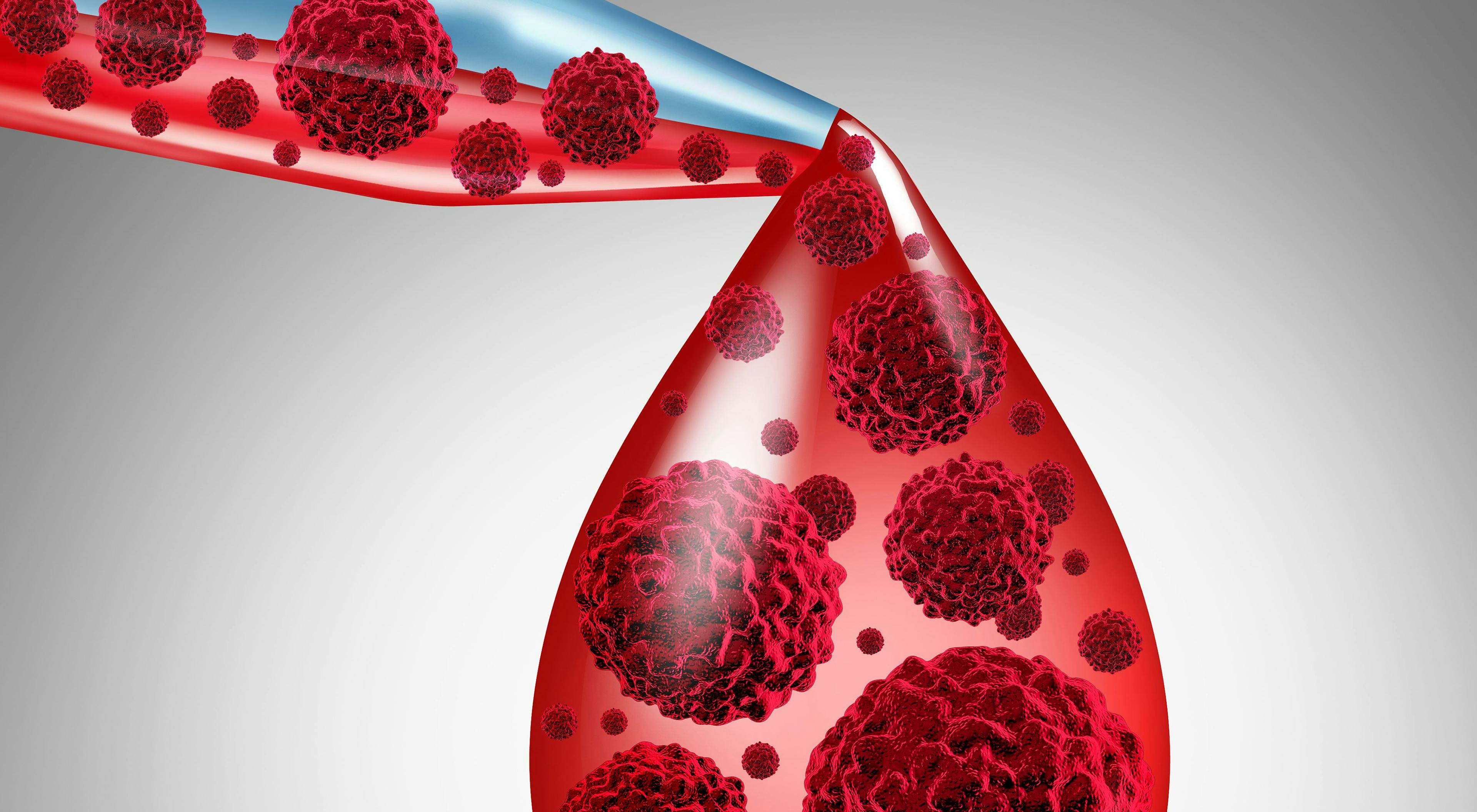 New and Upcoming Treatments Are Vastly Changing the Myeloma Space