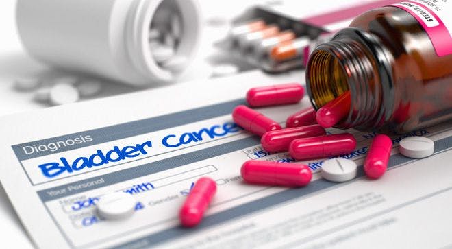 Combination with Higher Dose of Yervoy Shows Promise in Bladder Cancer