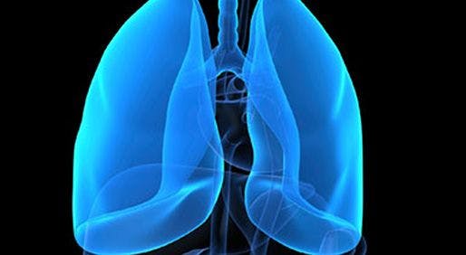 New Initiative Aims to 'Lock Up Lung Cancer'